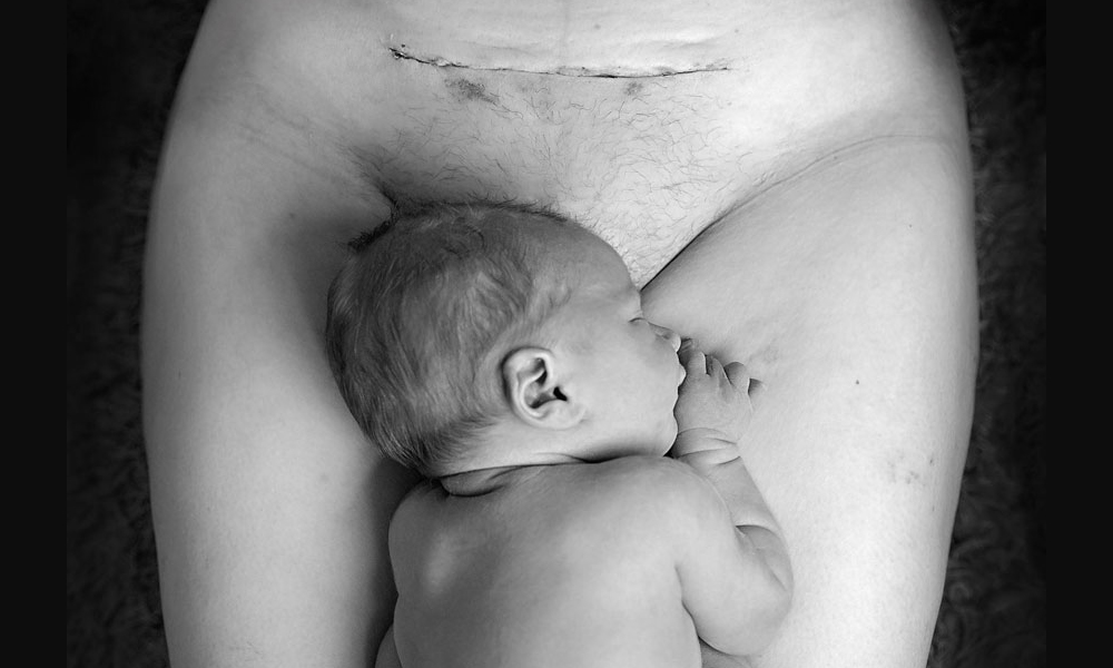 6 things to help you recover after a cesarean